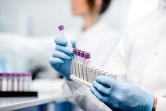 Análisis de sangre: ¿una nueva forma de detectar el Alzheimer?