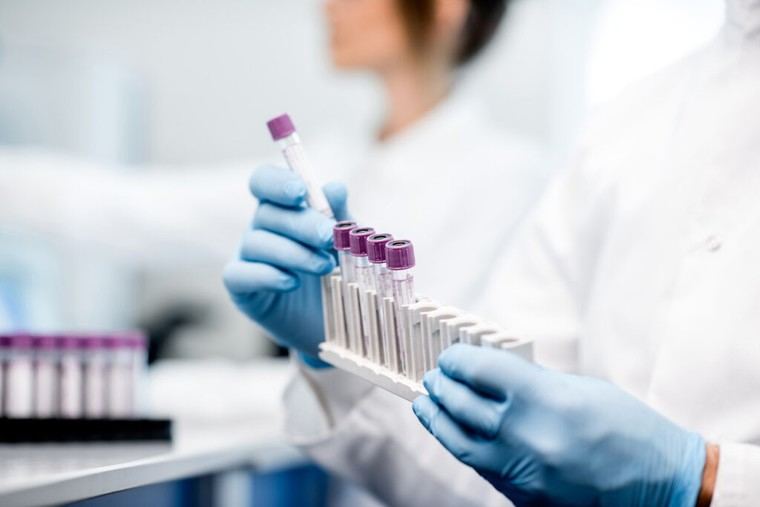 El análisis de biomarcadores en sangre se presenta como un método económicamente viable y poco invasivo, con un notable potencial para facilitar el diagnóstico del Alzheimer.